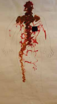 Contouren van lichaam met rode plekken 